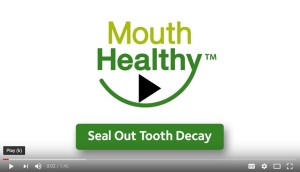 Video about dental sealants
